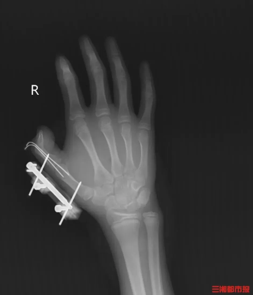 微信图片_2025-08-21_142932_680 微信图片_2025-08-21_142932_680